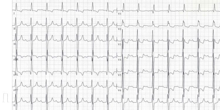 cardiología Sabadell