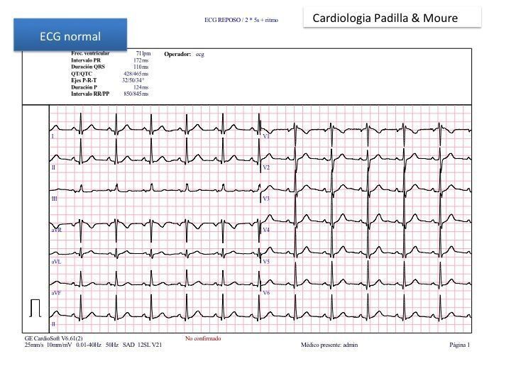 Electrocardiograma