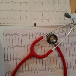 Fonendocospio sobre hoja de electrocardiograma