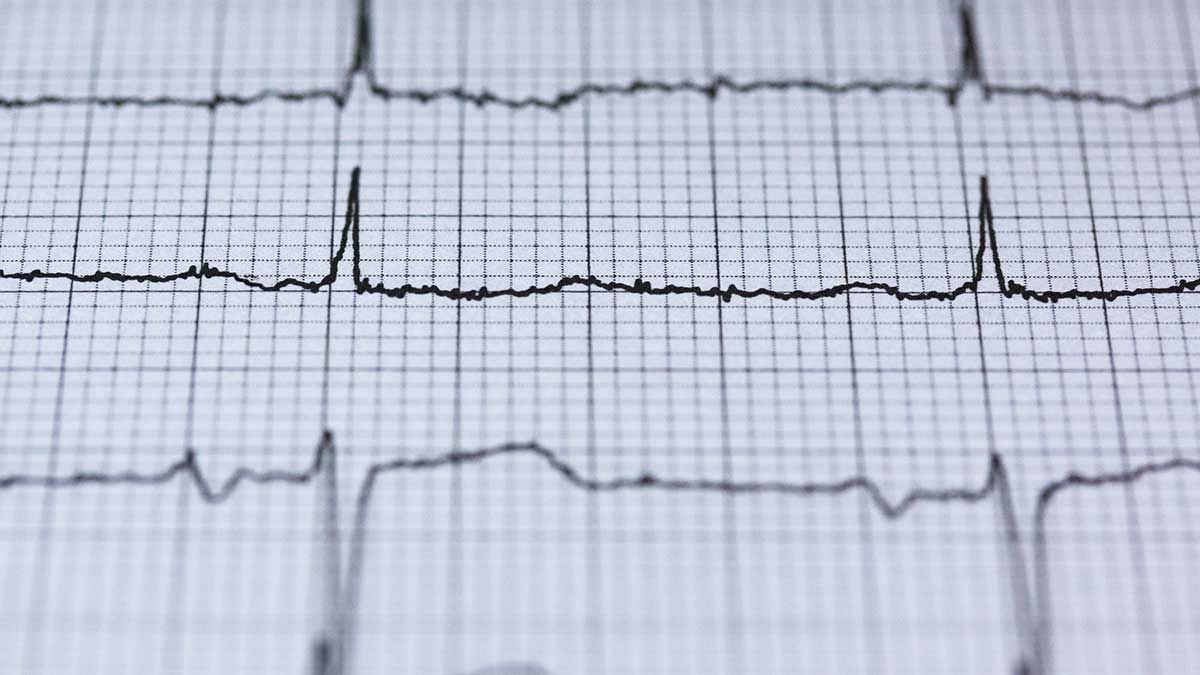 Holter ECG