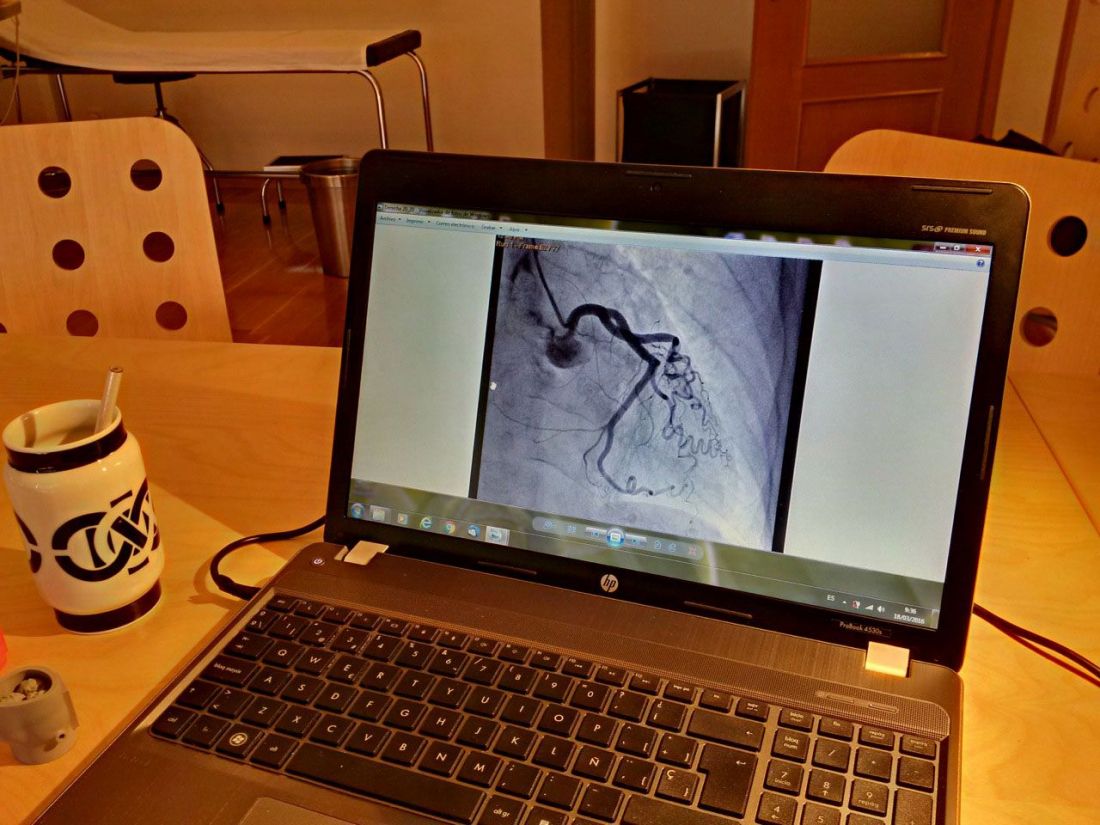 Monitorización de ecocardiograma