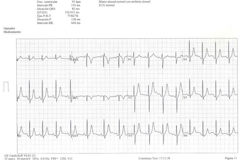 cardiología Sabadell