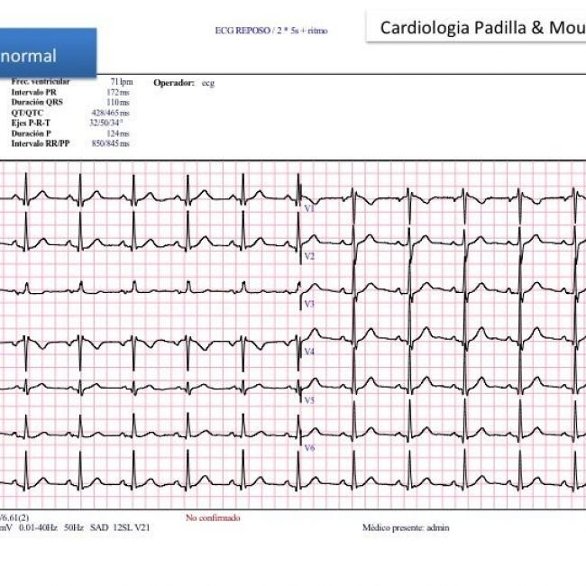 Electrocardiograma