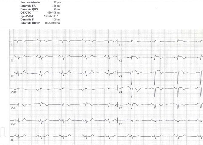 cardiología Sabadell