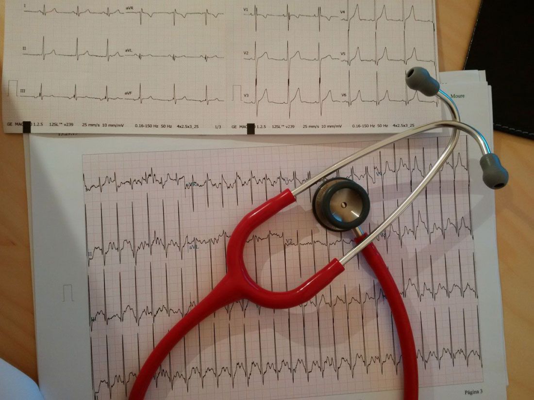 Fonendocospio sobre hoja de electrocardiograma