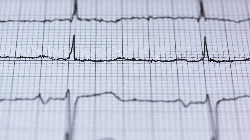 Holter ECG