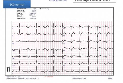 Electrocardiograma