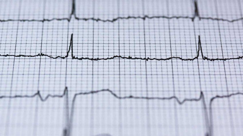 Holter ECG