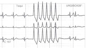 cardiología Sabadell